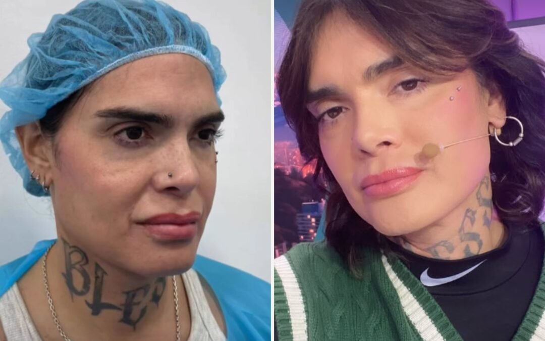 Nelson Mauri impacta tras someterse a retoque estético en el rostro: “Estoy feliz con el resultado”