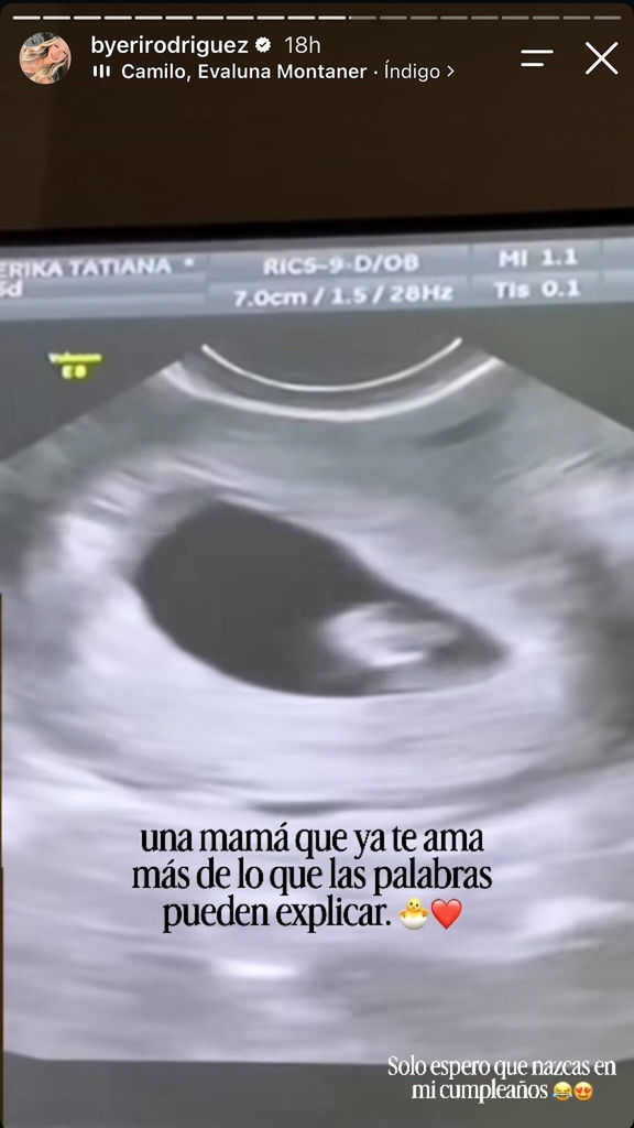 Historia de Érika Robayó
